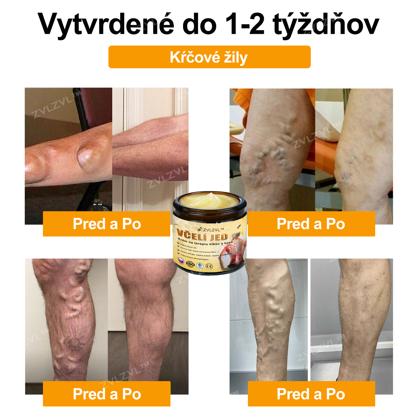 𝐙𝐕𝐋𝐙𝐕𝐋™🐝 𝐊𝐫é𝐦 𝐧𝐚 𝐳𝐦𝐢𝐞𝐫𝐧𝐞𝐧𝐢𝐞 𝐛𝐨𝐥𝐞𝐬𝐭𝐢 𝐤ĺ𝐛𝐨𝐯 𝐬 𝐯č𝐞𝐥í𝐦 𝐣𝐞𝐝𝐨𝐦 (❄ 𝐍𝐨𝐯ý 𝐳𝐢𝐦𝐧ý 𝐯ý𝐩𝐫𝐞𝐝𝐚𝐣 | ❄ 𝐀ž 𝐝𝐨 𝟕𝟎% 𝐳ľ𝐚𝐯𝐚)