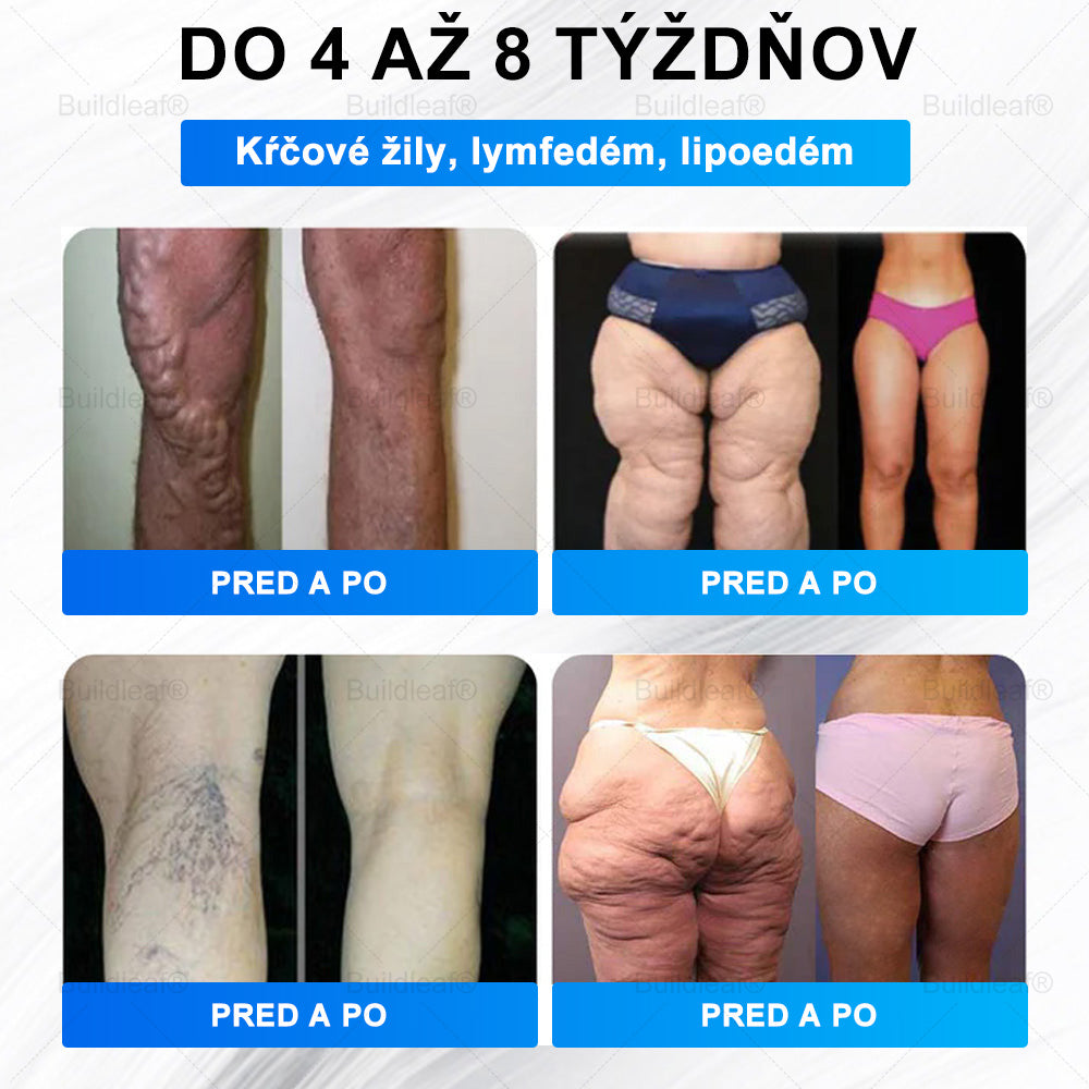 ⏰Zostáva už len 5 balení na sklade! Ponúkame dodatočnú zľavu 50 %! Zdravšie telo je na dosah! Ak to teraz premeškáte, budete musieť na ďalšiu príležitosť počkať až do budúceho roka!⏰
