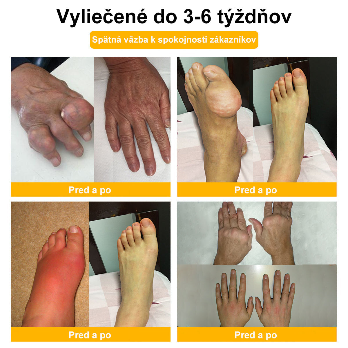 🍯🌿🍯 𝐁𝐄𝐀𝐑𝐍𝐈𝐂𝐀™ 𝐊𝐫é𝐦 𝐧𝐚 𝐤ĺ𝐛𝐲 𝐚 𝐤𝐨𝐬𝐭𝐢 𝐬 𝐯č𝐞𝐥í𝐦 𝐣𝐞𝐝𝐨𝐦🔥 (𝐏𝐨𝐬𝐥𝐞𝐝𝐧ý 𝐝𝐞ň 𝐚𝐤𝐜𝐢𝐞, 𝟖𝟎% 𝐳ľ𝐚𝐯𝐚)