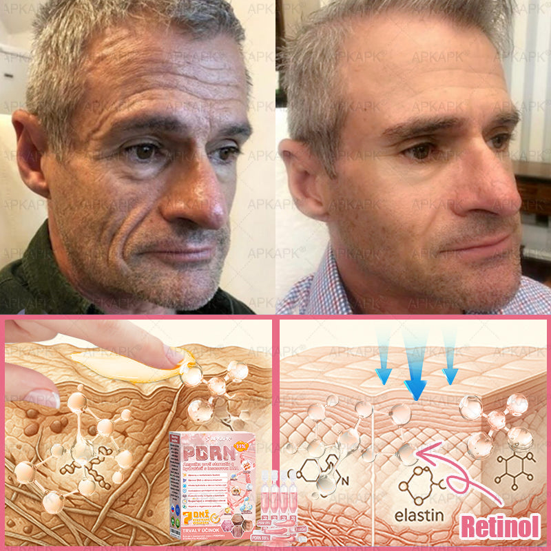 👨⚕️ Vyrobené a zaslané zo Slovenska ✨ APKAPK® 99% PDRN lososový DNA anti-aging ampulový roztok s 99% PDRN + včelí jed · 7x hlboká hydratácia | Rieši vrásky, suchosť, začervenanie, tmavé škvrny, purpuru a zápal — Viditeľné výsledky za 7 dní