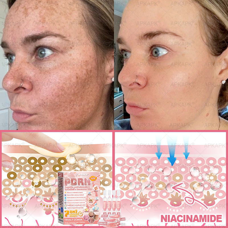 👨⚕️ Vyrobené a zaslané zo Slovenska ✨ APKAPK® 99% PDRN lososový DNA anti-aging ampulový roztok s 99% PDRN + včelí jed · 7x hlboká hydratácia | Rieši vrásky, suchosť, začervenanie, tmavé škvrny, purpuru a zápal — Viditeľné výsledky za 7 dní