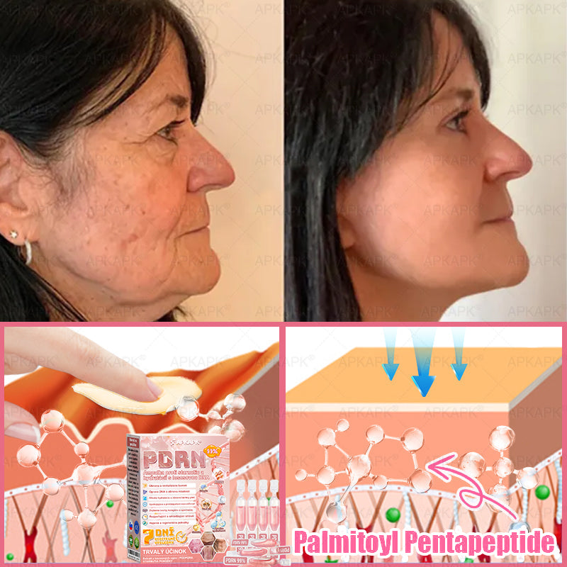 👨⚕️ Vyrobené a zaslané zo Slovenska ✨ APKAPK® 99% PDRN lososový DNA anti-aging ampulový roztok s 99% PDRN + včelí jed · 7x hlboká hydratácia | Rieši vrásky, suchosť, začervenanie, tmavé škvrny, purpuru a zápal — Viditeľné výsledky za 7 dní