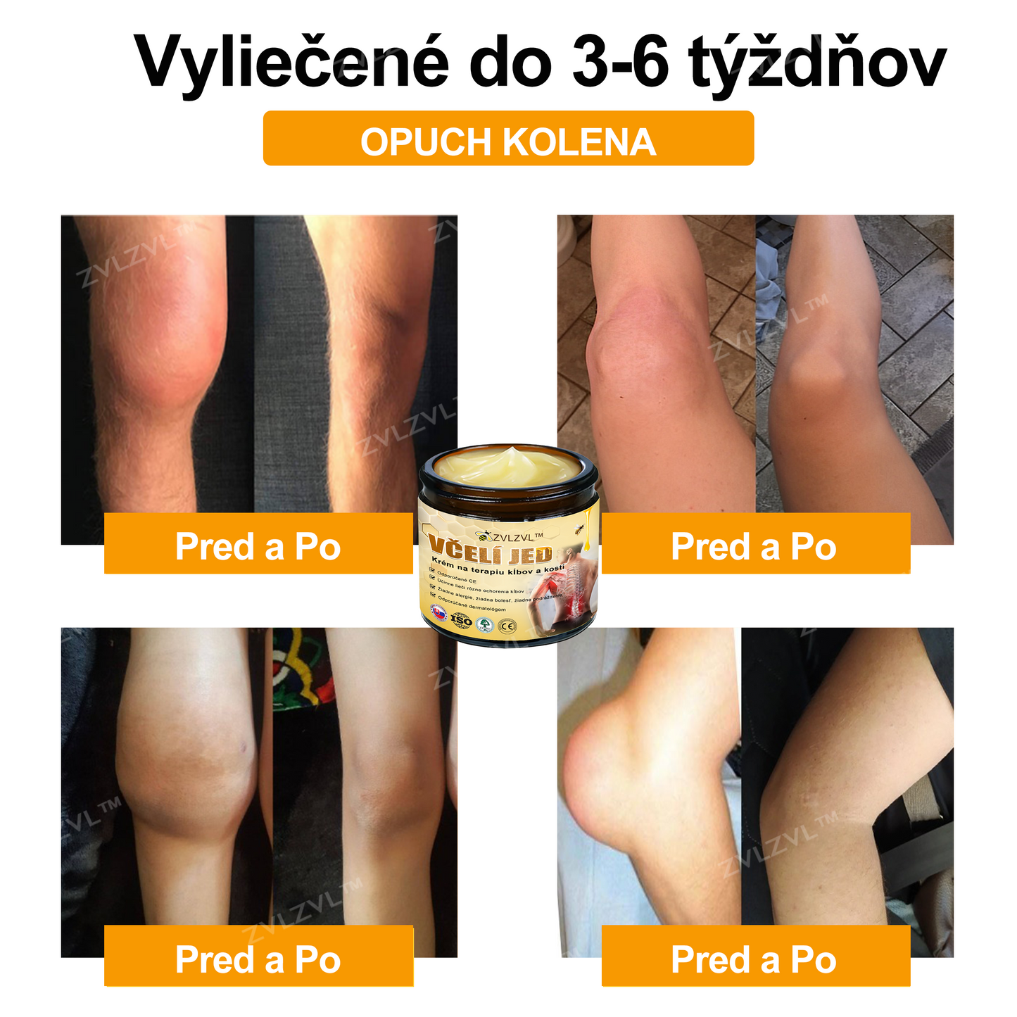 𝐙𝐕𝐋𝐙𝐕𝐋™🐝 𝐊𝐫é𝐦 𝐧𝐚 𝐳𝐦𝐢𝐞𝐫𝐧𝐞𝐧𝐢𝐞 𝐛𝐨𝐥𝐞𝐬𝐭𝐢 𝐤ĺ𝐛𝐨𝐯 𝐬 𝐯č𝐞𝐥í𝐦 𝐣𝐞𝐝𝐨𝐦 (❄ 𝐍𝐨𝐯ý 𝐳𝐢𝐦𝐧ý 𝐯ý𝐩𝐫𝐞𝐝𝐚𝐣 | ❄ 𝐀ž 𝐝𝐨 𝟕𝟎% 𝐳ľ𝐚𝐯𝐚)
