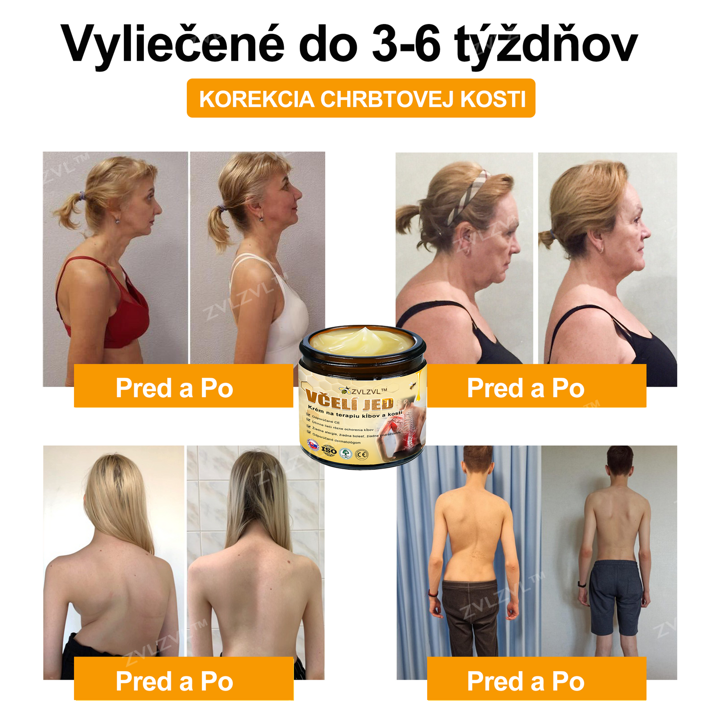𝐙𝐕𝐋𝐙𝐕𝐋™🐝 𝐊𝐫é𝐦 𝐧𝐚 𝐳𝐦𝐢𝐞𝐫𝐧𝐞𝐧𝐢𝐞 𝐛𝐨𝐥𝐞𝐬𝐭𝐢 𝐤ĺ𝐛𝐨𝐯 𝐬 𝐯č𝐞𝐥í𝐦 𝐣𝐞𝐝𝐨𝐦 (❄ 𝐍𝐨𝐯ý 𝐳𝐢𝐦𝐧ý 𝐯ý𝐩𝐫𝐞𝐝𝐚𝐣 | ❄ 𝐀ž 𝐝𝐨 𝟕𝟎% 𝐳ľ𝐚𝐯𝐚)