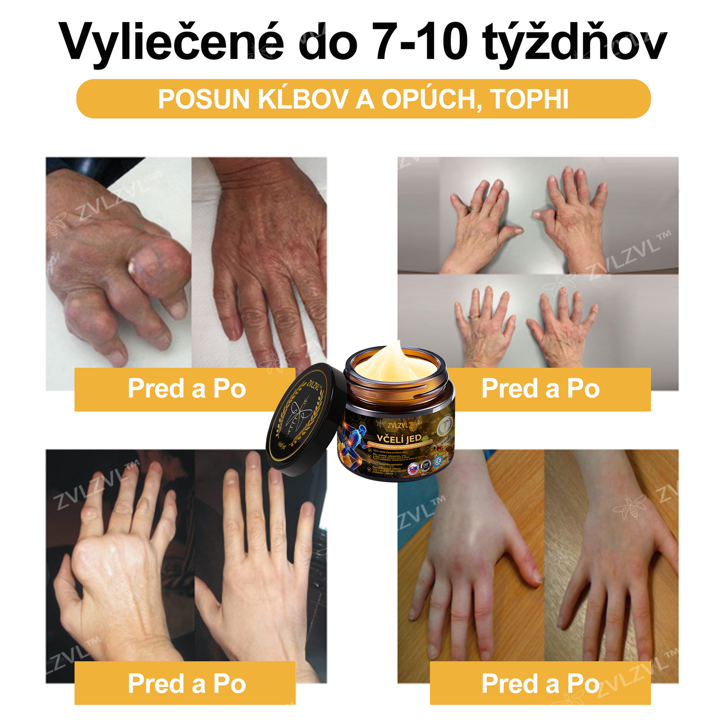 🎁🎁🌿 𝐔ž 𝐥𝐞𝐧 𝟓 𝐛𝐚𝐥𝐞𝐧í 𝐳𝐨𝐬𝐭𝐚𝐥𝐨! 𝐏𝐨𝐬𝐤𝐲𝐭𝐮𝐣𝐞𝐦𝐞 ď𝐚𝐥ší𝐜𝐡 𝟓𝟎% 𝐳ľ𝐚𝐯𝐮! 𝐙𝐝𝐫𝐚𝐯š𝐢𝐞 𝐭𝐞𝐥𝐨 𝐣𝐞 𝐧𝐚 𝐝𝐨𝐬𝐚𝐡! 𝐀𝐤 𝐭𝐞𝐫𝐚𝐳 𝐳𝐦𝐞š𝐤áš, 𝐝𝐨𝐬𝐭𝐚𝐧𝐞š 𝐭𝐨 𝐚ž 𝐛𝐮𝐝ú𝐜𝐢 𝐫𝐨𝐤.