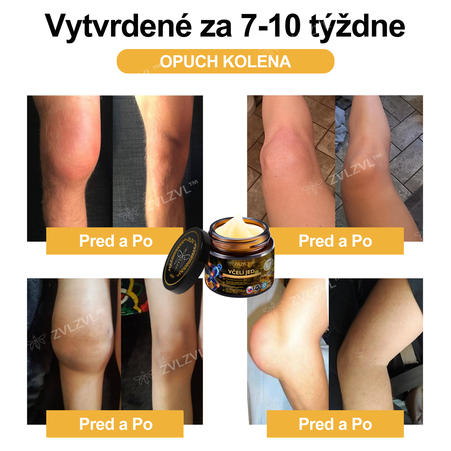 🎁🎁🌿 𝐔ž 𝐥𝐞𝐧 𝟓 𝐛𝐚𝐥𝐞𝐧í 𝐳𝐨𝐬𝐭𝐚𝐥𝐨! 𝐏𝐨𝐬𝐤𝐲𝐭𝐮𝐣𝐞𝐦𝐞 ď𝐚𝐥ší𝐜𝐡 𝟓𝟎% 𝐳ľ𝐚𝐯𝐮! 𝐙𝐝𝐫𝐚𝐯š𝐢𝐞 𝐭𝐞𝐥𝐨 𝐣𝐞 𝐧𝐚 𝐝𝐨𝐬𝐚𝐡! 𝐀𝐤 𝐭𝐞𝐫𝐚𝐳 𝐳𝐦𝐞š𝐤áš, 𝐝𝐨𝐬𝐭𝐚𝐧𝐞š 𝐭𝐨 𝐚ž 𝐛𝐮𝐝ú𝐜𝐢 𝐫𝐨𝐤.