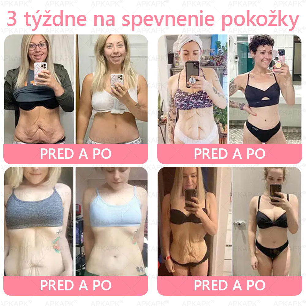 👨⚕️ Vyrobené a zaslané zo Slovenska ✨ APKAPK® 99% PDRN lososový DNA anti-aging ampulový roztok s 99% PDRN + včelí jed · 7x hlboká hydratácia | Rieši vrásky, suchosť, začervenanie, tmavé škvrny, purpuru a zápal — Viditeľné výsledky za 7 dní