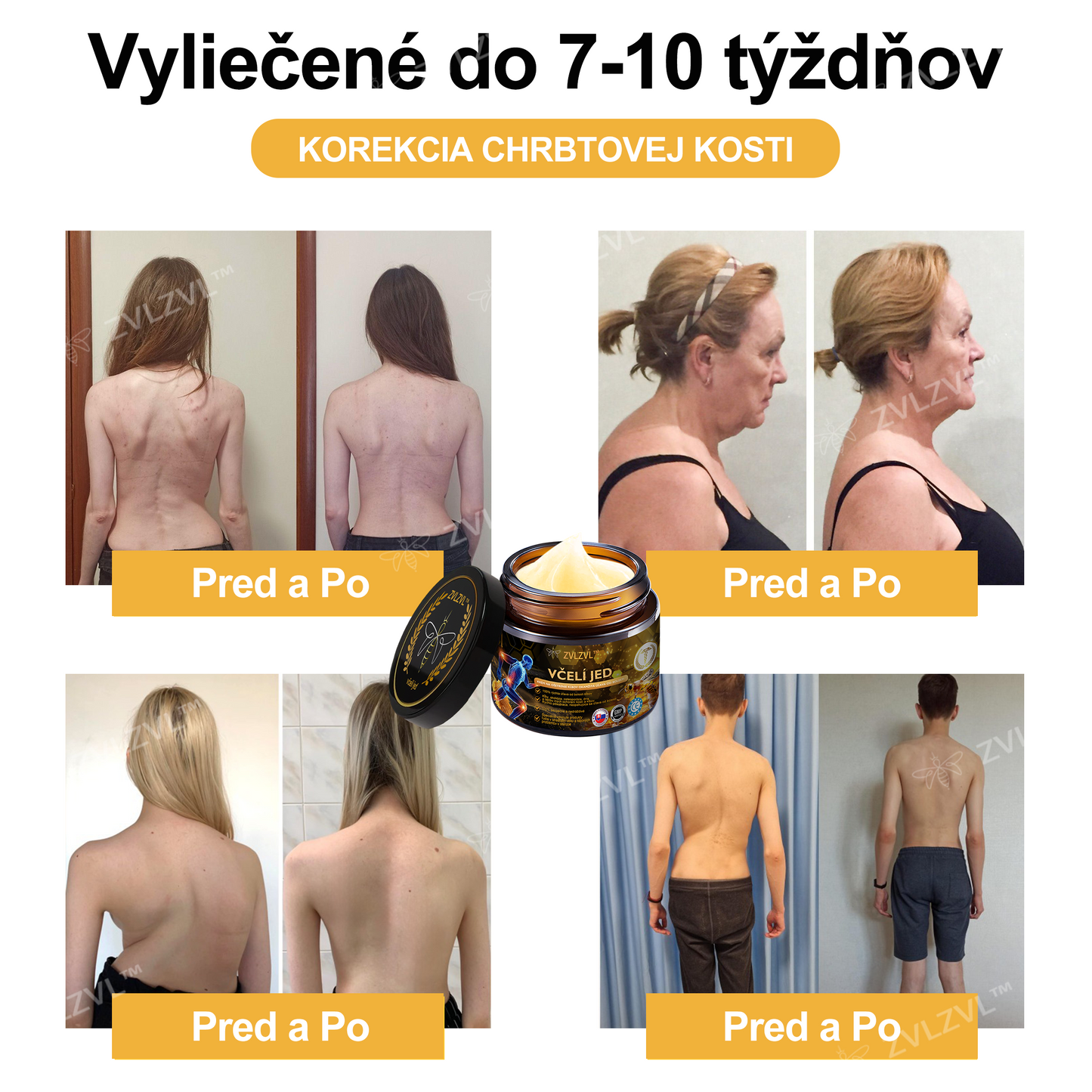 🎁🎁🌿 𝐔ž 𝐥𝐞𝐧 𝟓 𝐛𝐚𝐥𝐞𝐧í 𝐳𝐨𝐬𝐭𝐚𝐥𝐨! 𝐏𝐨𝐬𝐤𝐲𝐭𝐮𝐣𝐞𝐦𝐞 ď𝐚𝐥ší𝐜𝐡 𝟓𝟎% 𝐳ľ𝐚𝐯𝐮! 𝐙𝐝𝐫𝐚𝐯š𝐢𝐞 𝐭𝐞𝐥𝐨 𝐣𝐞 𝐧𝐚 𝐝𝐨𝐬𝐚𝐡! 𝐀𝐤 𝐭𝐞𝐫𝐚𝐳 𝐳𝐦𝐞š𝐤áš, 𝐝𝐨𝐬𝐭𝐚𝐧𝐞š 𝐭𝐨 𝐚ž 𝐛𝐮𝐝ú𝐜𝐢 𝐫𝐨𝐤.