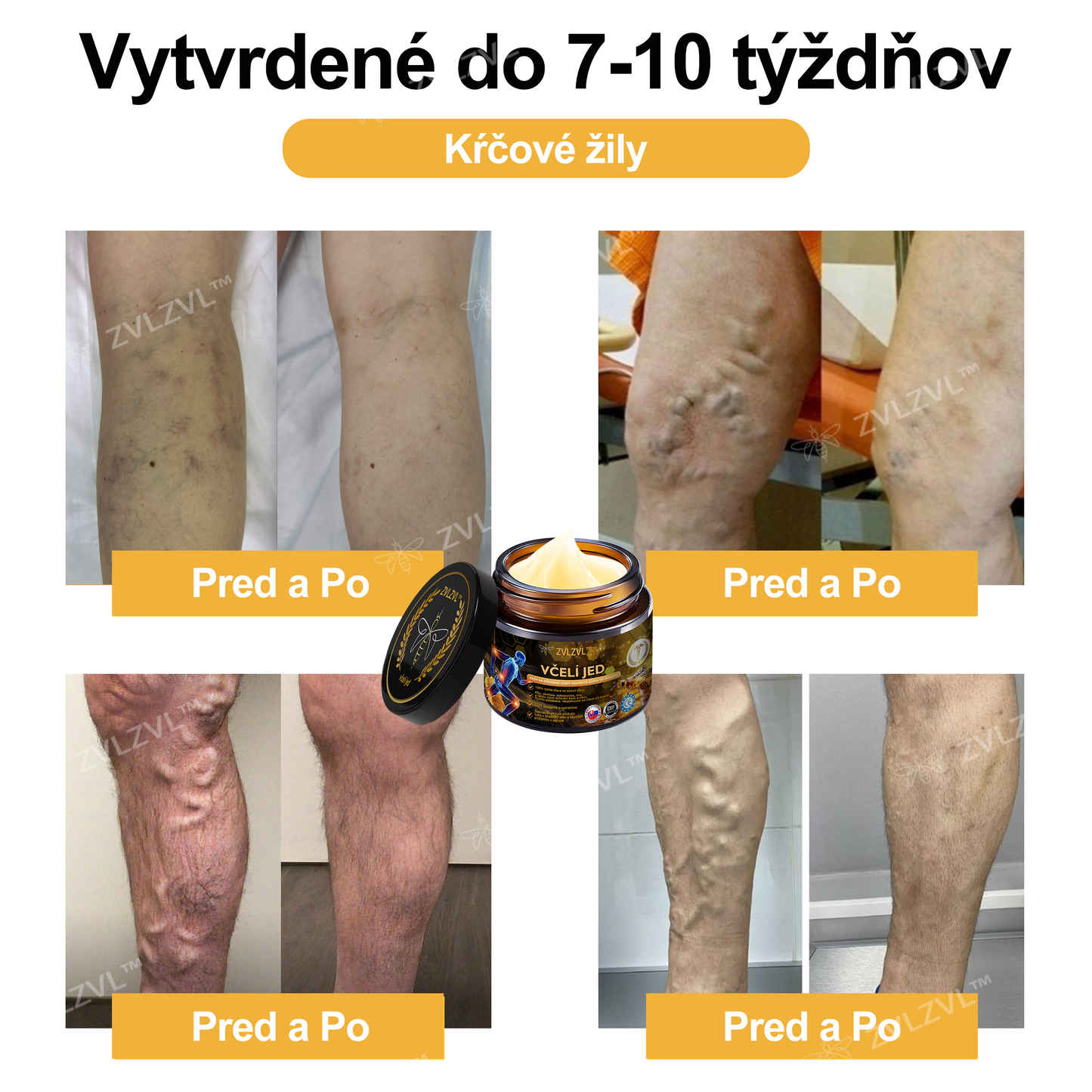 🎁🎁🌿 𝐔ž 𝐥𝐞𝐧 𝟓 𝐛𝐚𝐥𝐞𝐧í 𝐳𝐨𝐬𝐭𝐚𝐥𝐨! 𝐏𝐨𝐬𝐤𝐲𝐭𝐮𝐣𝐞𝐦𝐞 ď𝐚𝐥ší𝐜𝐡 𝟓𝟎% 𝐳ľ𝐚𝐯𝐮! 𝐙𝐝𝐫𝐚𝐯š𝐢𝐞 𝐭𝐞𝐥𝐨 𝐣𝐞 𝐧𝐚 𝐝𝐨𝐬𝐚𝐡! 𝐀𝐤 𝐭𝐞𝐫𝐚𝐳 𝐳𝐦𝐞š𝐤áš, 𝐝𝐨𝐬𝐭𝐚𝐧𝐞š 𝐭𝐨 𝐚ž 𝐛𝐮𝐝ú𝐜𝐢 𝐫𝐨𝐤.