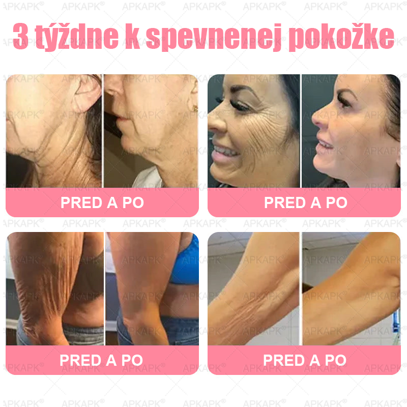 👨⚕️ Vyrobené a zaslané zo Slovenska ✨ APKAPK® 99% PDRN lososový DNA anti-aging ampulový roztok s 99% PDRN + včelí jed · 7x hlboká hydratácia | Rieši vrásky, suchosť, začervenanie, tmavé škvrny, purpuru a zápal — Viditeľné výsledky za 7 dní