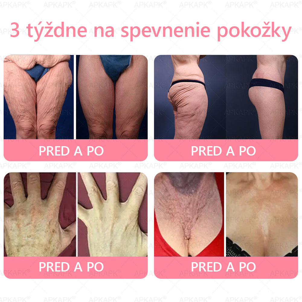 👨⚕️ Vyrobené a zaslané zo Slovenska ✨ APKAPK® 99% PDRN lososový DNA anti-aging ampulový roztok s 99% PDRN + včelí jed · 7x hlboká hydratácia | Rieši vrásky, suchosť, začervenanie, tmavé škvrny, purpuru a zápal — Viditeľné výsledky za 7 dní
