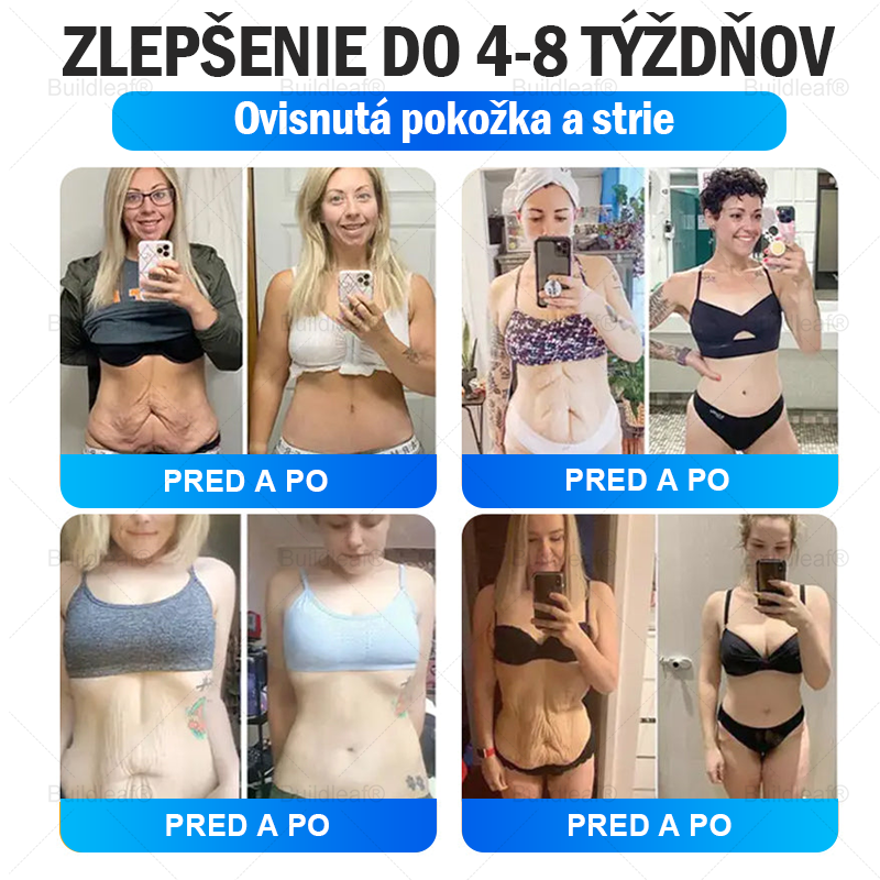 ⏰Zostáva už len 5 balení na sklade! Ponúkame dodatočnú zľavu 50 %! Zdravšie telo je na dosah! Ak to teraz premeškáte, budete musieť na ďalšiu príležitosť počkať až do budúceho roka!⏰