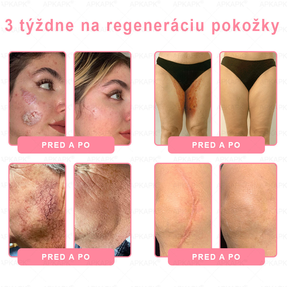 👨⚕️ Vyrobené a zaslané zo Slovenska ✨ APKAPK® 99% PDRN lososový DNA anti-aging ampulový roztok s 99% PDRN + včelí jed · 7x hlboká hydratácia | Rieši vrásky, suchosť, začervenanie, tmavé škvrny, purpuru a zápal — Viditeľné výsledky za 7 dní