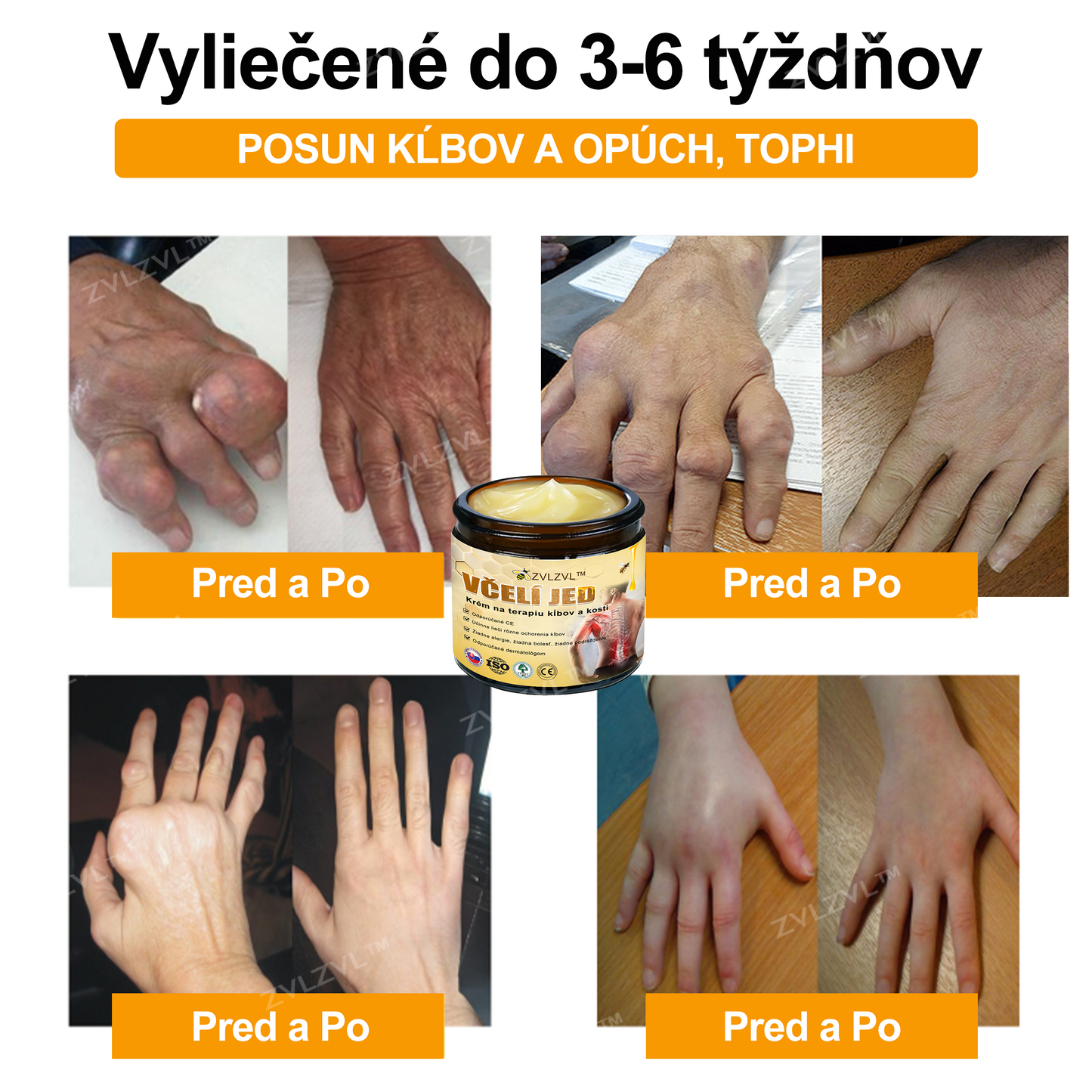 𝐙𝐕𝐋𝐙𝐕𝐋™🐝 𝐊𝐫é𝐦 𝐧𝐚 𝐳𝐦𝐢𝐞𝐫𝐧𝐞𝐧𝐢𝐞 𝐛𝐨𝐥𝐞𝐬𝐭𝐢 𝐤ĺ𝐛𝐨𝐯 𝐬 𝐯č𝐞𝐥í𝐦 𝐣𝐞𝐝𝐨𝐦 (❄ 𝐍𝐨𝐯ý 𝐳𝐢𝐦𝐧ý 𝐯ý𝐩𝐫𝐞𝐝𝐚𝐣 | ❄ 𝐀ž 𝐝𝐨 𝟕𝟎% 𝐳ľ𝐚𝐯𝐚)