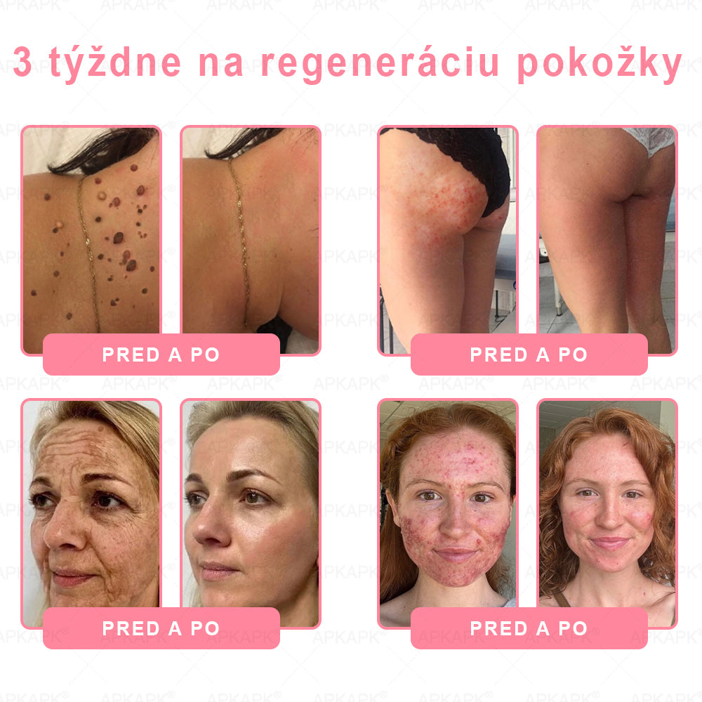👨⚕️ Vyrobené a zaslané zo Slovenska ✨ APKAPK® 99% PDRN lososový DNA anti-aging ampulový roztok s 99% PDRN + včelí jed · 7x hlboká hydratácia | Rieši vrásky, suchosť, začervenanie, tmavé škvrny, purpuru a zápal — Viditeľné výsledky za 7 dní