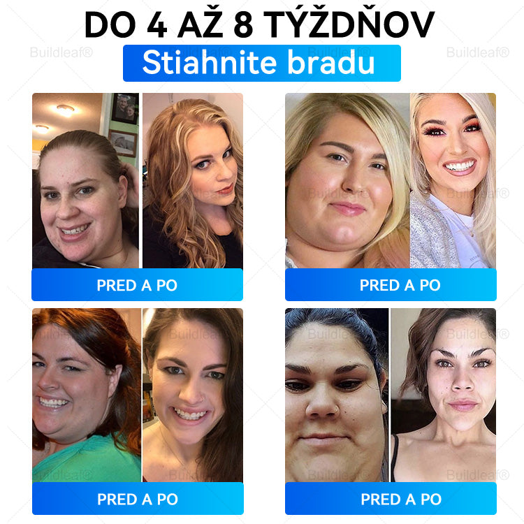 ⏰Zostáva už len 5 balení na sklade! Ponúkame dodatočnú zľavu 50 %! Zdravšie telo je na dosah! Ak to teraz premeškáte, budete musieť na ďalšiu príležitosť počkať až do budúceho roka!⏰