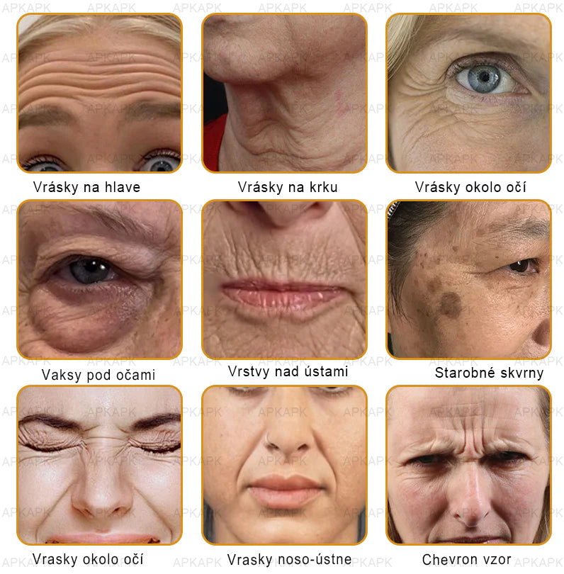 𝐀𝐏𝐊𝐀𝐏𝐊™ 𝐕č𝐞𝐥í 𝐉𝐞𝐝 𝐊𝐫é𝐦 𝐍𝐚 𝐑𝐞𝐠𝐞𝐧𝐞𝐫á𝐜𝐢𝐮 𝐏𝐥𝐞𝐭𝐢 🧑⚕️𝐎š𝐞𝐭𝐫𝐞𝐧𝐢𝐞 𝐤𝐨ž𝐧ý𝐜𝐡 𝐩𝐫𝐨𝐛𝐥é𝐦𝐨𝐯 𝐳𝐚𝐡ŕň𝐚: 𝐯𝐞𝐤𝐨𝐯é š𝐤𝐯𝐫𝐧𝐲, 𝐣𝐚𝐳𝐯𝐲, 𝐛𝐫𝐚𝐝𝐚𝐯𝐢𝐜𝐞, 𝐤𝐨ž𝐧é 𝐯ý𝐫𝐚𝐬𝐭𝐤𝐲, 𝐟𝐮𝐫𝐮𝐧𝐤𝐥𝐲, 𝐚𝐤𝐧é, 𝐞𝐤𝐳é𝐦𝐲, 𝐩𝐬𝐨𝐫𝐢á𝐳𝐮, 𝐚𝐤𝐧é 𝐢𝐧𝐯𝐞𝐫𝐬𝐚, 𝐯𝐫á𝐬𝐤𝐲, 𝐬𝐭𝐚𝐫𝐧𝐮𝐭𝐢𝐞 𝐩𝐥𝐞𝐭𝐢 𝐚 ď𝐚𝐥š𝐢𝐞.🔥