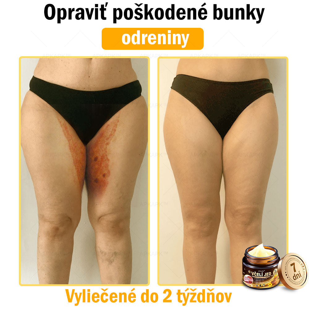 Zostalo už len 5 plechoviek! Ponúkame 50% extra zľavu! Udržujte svoju pleť zdravú. Ak to teraz zmeškáte, budete mať šancu až budúci rok!