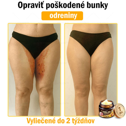 Zostalo už len 5 plechoviek! Ponúkame 50% extra zľavu! Udržujte svoju pleť zdravú. Ak to teraz zmeškáte, budete mať šancu až budúci rok!