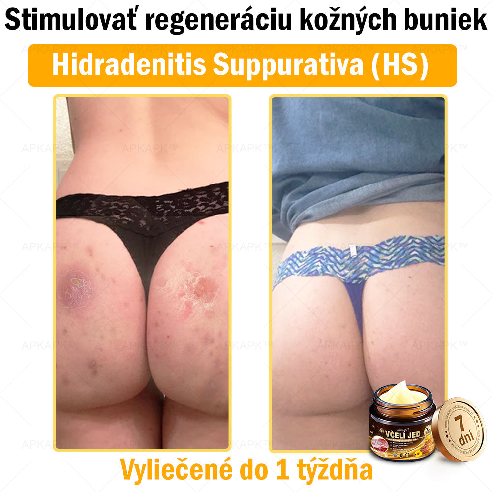 Zostalo už len 5 plechoviek! Ponúkame 50% extra zľavu! Udržujte svoju pleť zdravú. Ak to teraz zmeškáte, budete mať šancu až budúci rok!