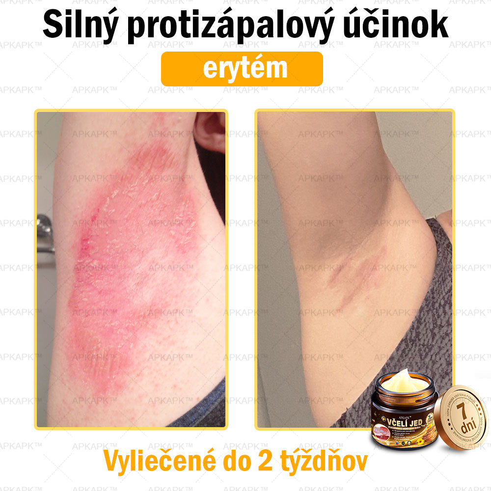 Zostalo už len 5 plechoviek! Ponúkame 50% extra zľavu! Udržujte svoju pleť zdravú. Ak to teraz zmeškáte, budete mať šancu až budúci rok!