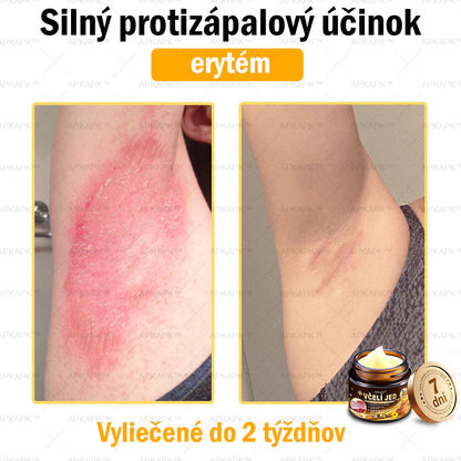 Zostalo už len 5 plechoviek! Ponúkame 50% extra zľavu! Udržujte svoju pleť zdravú. Ak to teraz zmeškáte, budete mať šancu až budúci rok!