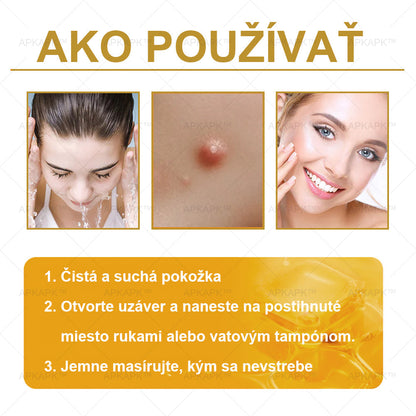 Zostalo už len 5 plechoviek! Ponúkame 50% extra zľavu! Udržujte svoju pleť zdravú. Ak to teraz zmeškáte, budete mať šancu až budúci rok!