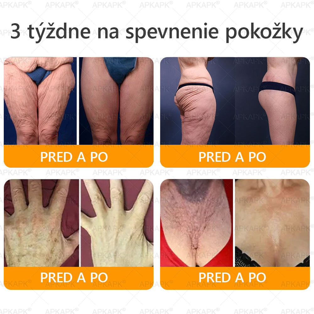 Vyrobené a odoslané zo Slovenska ✨𝖠𝖯𝖪𝖠𝖯𝖪® 𝖡𝖾𝖾 𝗏𝖾𝗇𝗈𝗆 𝖪𝗋𝖾𝗆 𝗇𝖺 𝗈𝗉𝗋𝖺𝗏𝗎 𝗉𝗅𝖾𝗍𝗂