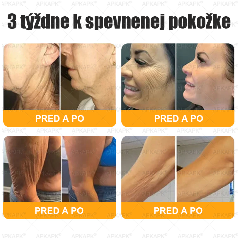 Vyrobené a odoslané zo Slovenska ✨𝖠𝖯𝖪𝖠𝖯𝖪® 𝖡𝖾𝖾 𝗏𝖾𝗇𝗈𝗆 𝖪𝗋𝖾𝗆 𝗇𝖺 𝗈𝗉𝗋𝖺𝗏𝗎 𝗉𝗅𝖾𝗍𝗂