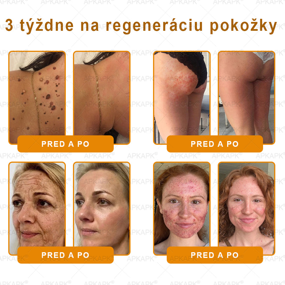 Vyrobené a odoslané zo Slovenska ✨𝖠𝖯𝖪𝖠𝖯𝖪® 𝖡𝖾𝖾 𝗏𝖾𝗇𝗈𝗆 𝖪𝗋𝖾𝗆 𝗇𝖺 𝗈𝗉𝗋𝖺𝗏𝗎 𝗉𝗅𝖾𝗍𝗂