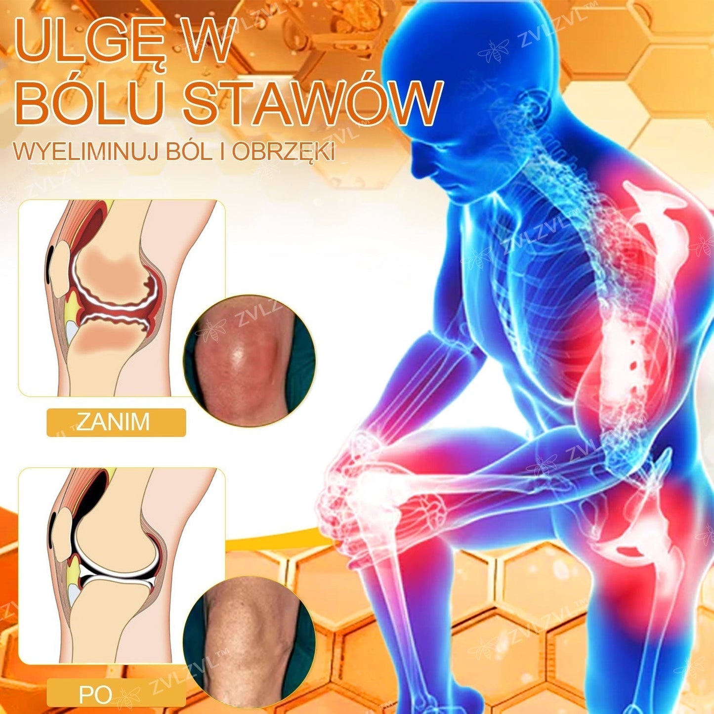 𝐙𝐕𝐋𝐙𝐕𝐋™🐝 𝐊𝐫é𝐦 𝐧𝐚 𝐳𝐦𝐢𝐞𝐫𝐧𝐞𝐧𝐢𝐞 𝐛𝐨𝐥𝐞𝐬𝐭𝐢 𝐤ĺ𝐛𝐨𝐯 𝐬 𝐯č𝐞𝐥í𝐦 𝐣𝐞𝐝𝐨𝐦 (❄ 𝐍𝐨𝐯ý 𝐳𝐢𝐦𝐧ý 𝐯ý𝐩𝐫𝐞𝐝𝐚𝐣 | ❄ 𝐀ž 𝐝𝐨 𝟕𝟎% 𝐳ľ𝐚𝐯𝐚)