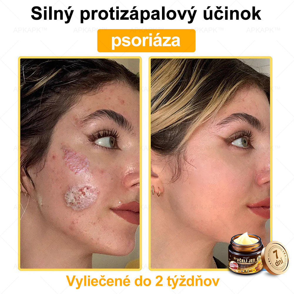 Zostalo už len 5 plechoviek! Ponúkame 50% extra zľavu! Udržujte svoju pleť zdravú. Ak to teraz zmeškáte, budete mať šancu až budúci rok!