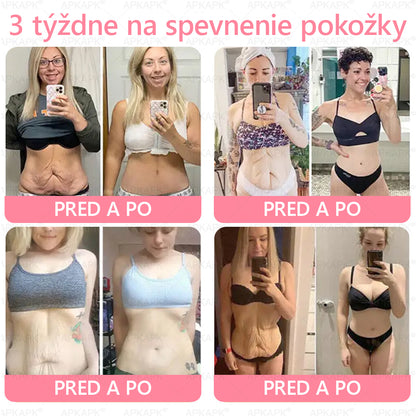 👨‍⚕️ Vyrobené a zaslané zo Slovenska ✨ APKAPK® 99% PDRN lososový DNA anti-aging ampulový roztok s 99% PDRN + včelí jed · 7x hlboká hydratácia | Rieši vrásky, suchosť, začervenanie, tmavé škvrny, purpuru a zápal — Viditeľné výsledky za 7 dní