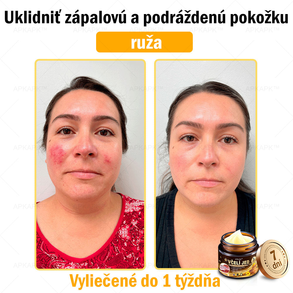 Zostalo už len 5 plechoviek! Ponúkame 50% extra zľavu! Udržujte svoju pleť zdravú. Ak to teraz zmeškáte, budete mať šancu až budúci rok!