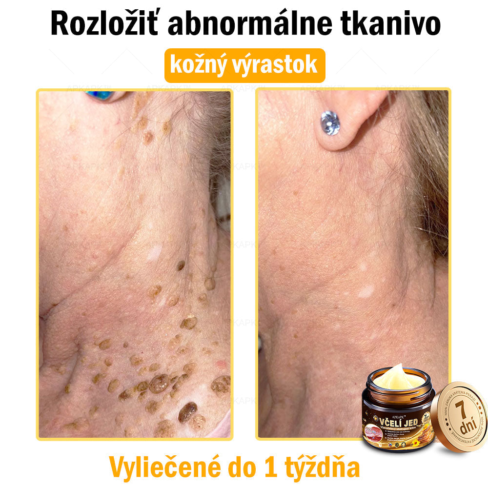Zostalo už len 5 plechoviek! Ponúkame 50% extra zľavu! Udržujte svoju pleť zdravú. Ak to teraz zmeškáte, budete mať šancu až budúci rok!