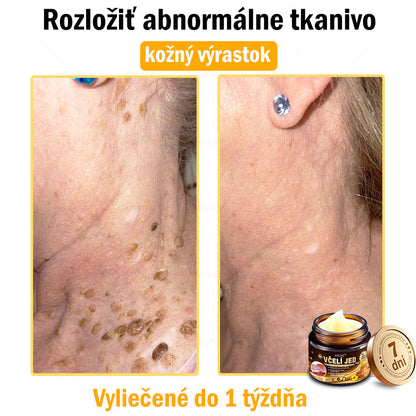 Zostalo už len 5 plechoviek! Ponúkame 50% extra zľavu! Udržujte svoju pleť zdravú. Ak to teraz zmeškáte, budete mať šancu až budúci rok!