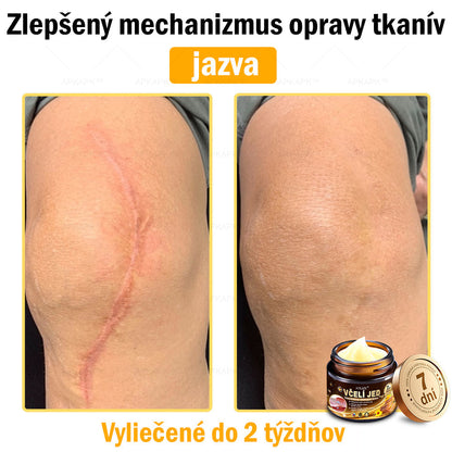 Zostalo už len 5 plechoviek! Ponúkame 50% extra zľavu! Udržujte svoju pleť zdravú. Ak to teraz zmeškáte, budete mať šancu až budúci rok!