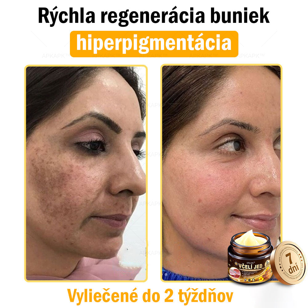 Zostalo už len 5 plechoviek! Ponúkame 50% extra zľavu! Udržujte svoju pleť zdravú. Ak to teraz zmeškáte, budete mať šancu až budúci rok!