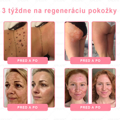 👨‍⚕️ Vyrobené a zaslané zo Slovenska ✨ APKAPK® 99% PDRN lososový DNA anti-aging ampulový roztok s 99% PDRN + včelí jed · 7x hlboká hydratácia | Rieši vrásky, suchosť, začervenanie, tmavé škvrny, purpuru a zápal — Viditeľné výsledky za 7 dní