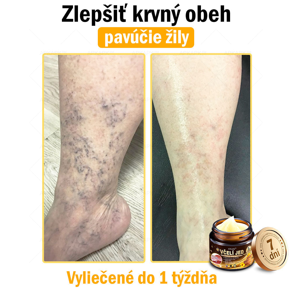 Zostalo už len 5 plechoviek! Ponúkame 50% extra zľavu! Udržujte svoju pleť zdravú. Ak to teraz zmeškáte, budete mať šancu až budúci rok!