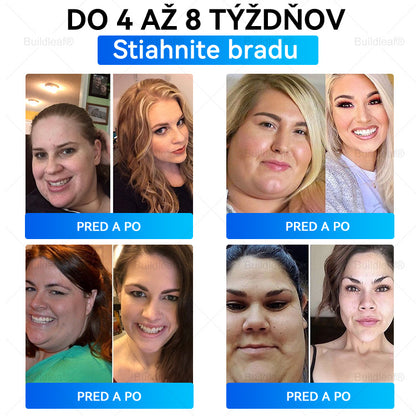 👩dporúčané klinikou Mayo | Buildleaf®🌿 Tirzepatidový zoštíhľujúci a zdravotný nano-mikroihlový náplasť🔥 Obezita, kardiovaskulárne ochorenia, cukrovka, spánkové apnoe, problémy s kĺbmi a ďalšie