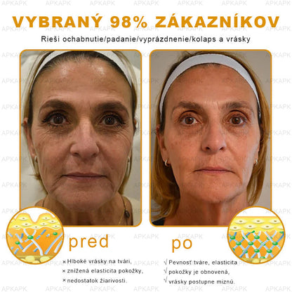 Zostalo už len 5 plechoviek! Ponúkame 50% extra zľavu! Udržujte svoju pleť zdravú. Ak to teraz zmeškáte, budete mať šancu až budúci rok!